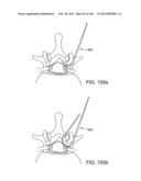 ACCESS AND TISSUE MODIFICATION SYSTEMS AND METHODS diagram and image