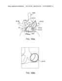 ACCESS AND TISSUE MODIFICATION SYSTEMS AND METHODS diagram and image