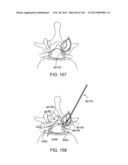 ACCESS AND TISSUE MODIFICATION SYSTEMS AND METHODS diagram and image