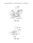 ACCESS AND TISSUE MODIFICATION SYSTEMS AND METHODS diagram and image