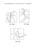 ACCESS AND TISSUE MODIFICATION SYSTEMS AND METHODS diagram and image