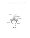 DEVICES, METHODS AND SYSTEMS FOR NEURAL LOCALIZATION diagram and image