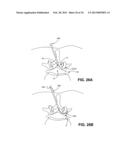 DEVICES, METHODS AND SYSTEMS FOR NEURAL LOCALIZATION diagram and image