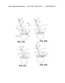 DEVICES, METHODS AND SYSTEMS FOR NEURAL LOCALIZATION diagram and image