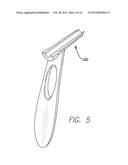 PRECISION HIP REPLACEMENT METHOD diagram and image