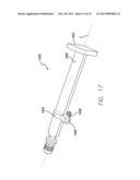 PRECISION HIP REPLACEMENT METHOD diagram and image