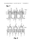 Suture and Retainer Assembly and SULU diagram and image