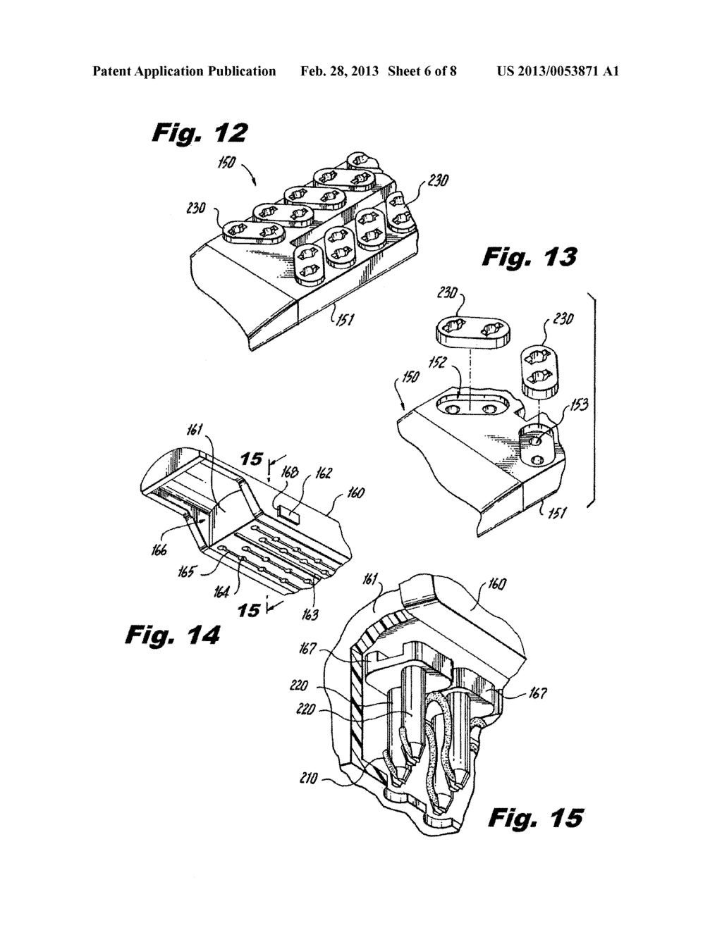 Suture and Retainer Assembly and SULU - diagram, schematic, and image 07