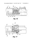 Suture and Retainer Assembly and SULU diagram and image