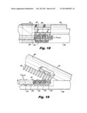 Suture and Retainer Assembly and SULU diagram and image