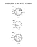 MEDICAL IMPLANT WITH FLOATING MAGNETS diagram and image