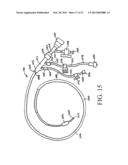 COIL OCCLUSION DEVICES AND SYSTEMS AND METHODS OF USING THE SAME diagram and image