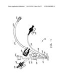 COIL OCCLUSION DEVICES AND SYSTEMS AND METHODS OF USING THE SAME diagram and image