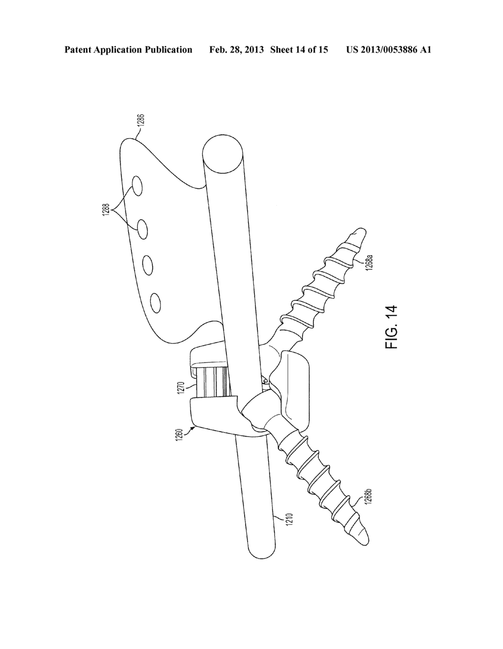 SYSTEM AND METHOD FOR CERVICAL MIDLINE FIXATION - diagram, schematic, and image 15