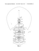 SYSTEM AND METHOD FOR CERVICAL MIDLINE FIXATION diagram and image