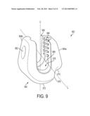 SYSTEM AND METHOD FOR CERVICAL MIDLINE FIXATION diagram and image