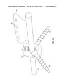 SYSTEM AND METHOD FOR CERVICAL MIDLINE FIXATION diagram and image