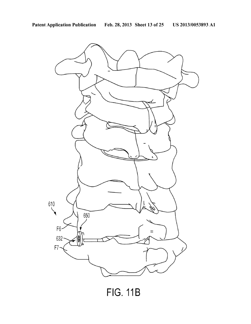 DEVICES AND METHODS FOR CERVICAL LATERAL FIXATION - diagram, schematic, and image 14