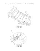 DEVICES AND METHODS FOR CERVICAL LATERAL FIXATION diagram and image