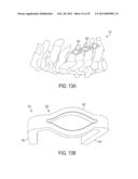 DEVICES AND METHODS FOR CERVICAL LATERAL FIXATION diagram and image