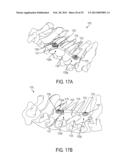 DEVICES AND METHODS FOR CERVICAL LATERAL FIXATION diagram and image