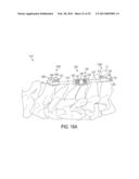 DEVICES AND METHODS FOR CERVICAL LATERAL FIXATION diagram and image