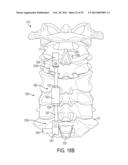 DEVICES AND METHODS FOR CERVICAL LATERAL FIXATION diagram and image