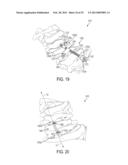 DEVICES AND METHODS FOR CERVICAL LATERAL FIXATION diagram and image