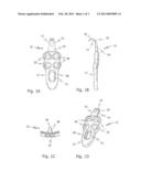 BONE PLATE WITH HOOK PORTION diagram and image