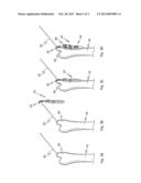 BONE PLATE WITH HOOK PORTION diagram and image