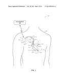 FAULT-TOLERANT HIGH VOLTAGE DELIVERY IN AN IMPLANTABLE MEDICAL DEVICE diagram and image