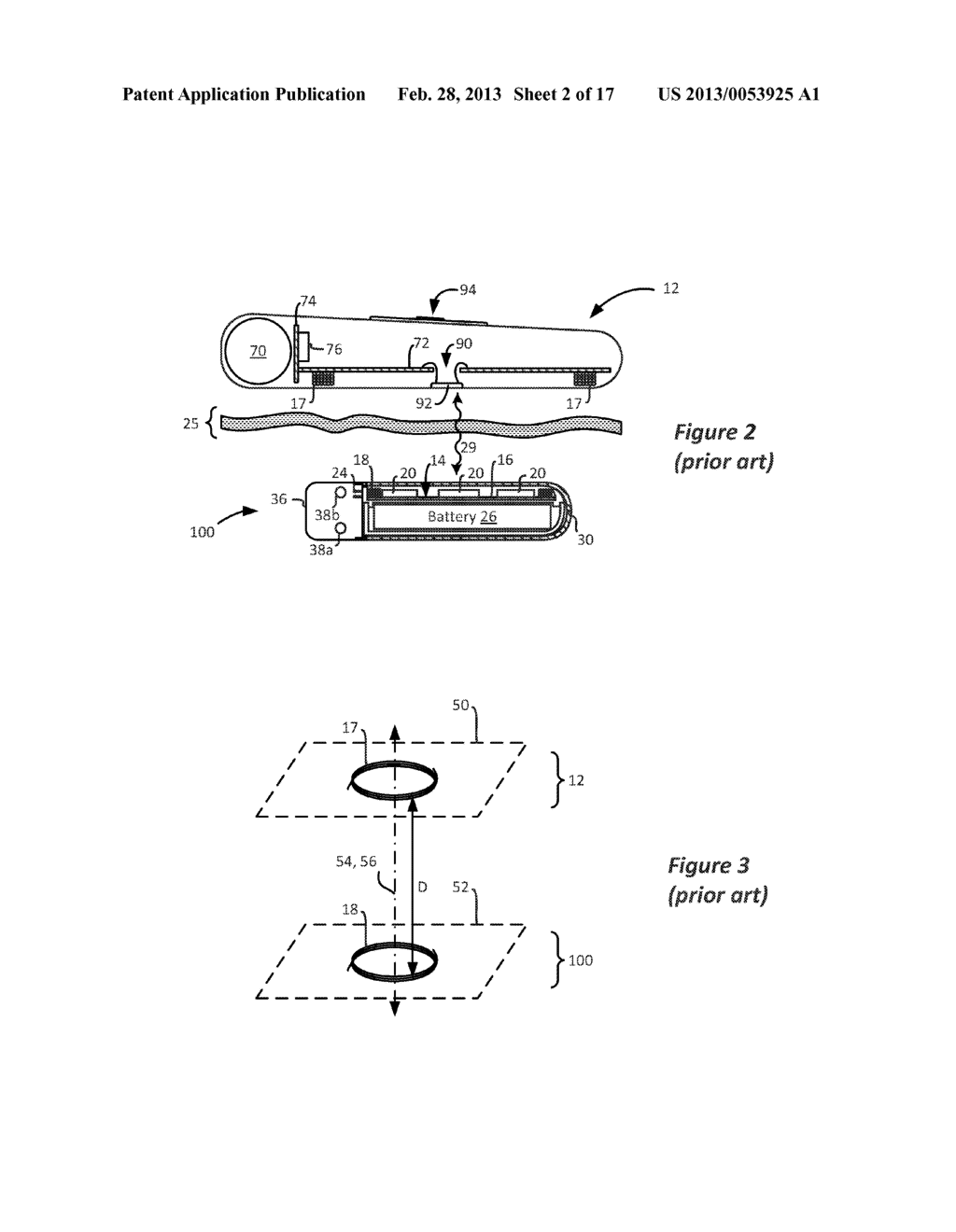 External Charger Usable with an Implantable Medical Device Having a     Programmable or Time-Varying Temperature Set Point - diagram, schematic, and image 03