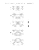 Deformable Lumen Support Devices and Methods of Use diagram and image