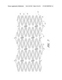 Deformable Lumen Support Devices and Methods of Use diagram and image