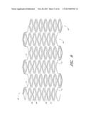 Deformable Lumen Support Devices and Methods of Use diagram and image