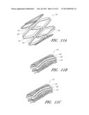 Deformable Lumen Support Devices and Methods of Use diagram and image