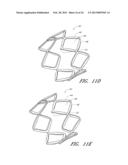 Deformable Lumen Support Devices and Methods of Use diagram and image