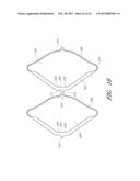 Deformable Lumen Support Devices and Methods of Use diagram and image