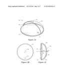 ACCOMMODATING INTRAOCULAR LENS DEVICE diagram and image