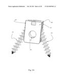 BI-DIRECTIONAL FIXATING TRANSVERTEBRAL BODY SCREWS AND POSTERIOR CERVICAL     AND LUMBAR INTERARTICULATING JOINT CALIBRATED STAPLING DEVICES FOR SPINAL     FUSION diagram and image