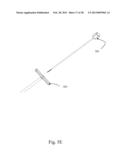 BI-DIRECTIONAL FIXATING TRANSVERTEBRAL BODY SCREWS AND POSTERIOR CERVICAL     AND LUMBAR INTERARTICULATING JOINT CALIBRATED STAPLING DEVICES FOR SPINAL     FUSION diagram and image