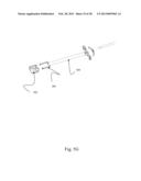 BI-DIRECTIONAL FIXATING TRANSVERTEBRAL BODY SCREWS AND POSTERIOR CERVICAL     AND LUMBAR INTERARTICULATING JOINT CALIBRATED STAPLING DEVICES FOR SPINAL     FUSION diagram and image