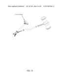 BI-DIRECTIONAL FIXATING TRANSVERTEBRAL BODY SCREWS AND POSTERIOR CERVICAL     AND LUMBAR INTERARTICULATING JOINT CALIBRATED STAPLING DEVICES FOR SPINAL     FUSION diagram and image