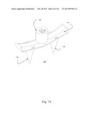 BI-DIRECTIONAL FIXATING TRANSVERTEBRAL BODY SCREWS AND POSTERIOR CERVICAL     AND LUMBAR INTERARTICULATING JOINT CALIBRATED STAPLING DEVICES FOR SPINAL     FUSION diagram and image