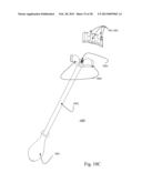 BI-DIRECTIONAL FIXATING TRANSVERTEBRAL BODY SCREWS AND POSTERIOR CERVICAL     AND LUMBAR INTERARTICULATING JOINT CALIBRATED STAPLING DEVICES FOR SPINAL     FUSION diagram and image