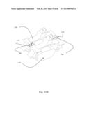 BI-DIRECTIONAL FIXATING TRANSVERTEBRAL BODY SCREWS AND POSTERIOR CERVICAL     AND LUMBAR INTERARTICULATING JOINT CALIBRATED STAPLING DEVICES FOR SPINAL     FUSION diagram and image