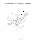 BI-DIRECTIONAL FIXATING TRANSVERTEBRAL BODY SCREWS AND POSTERIOR CERVICAL     AND LUMBAR INTERARTICULATING JOINT CALIBRATED STAPLING DEVICES FOR SPINAL     FUSION diagram and image