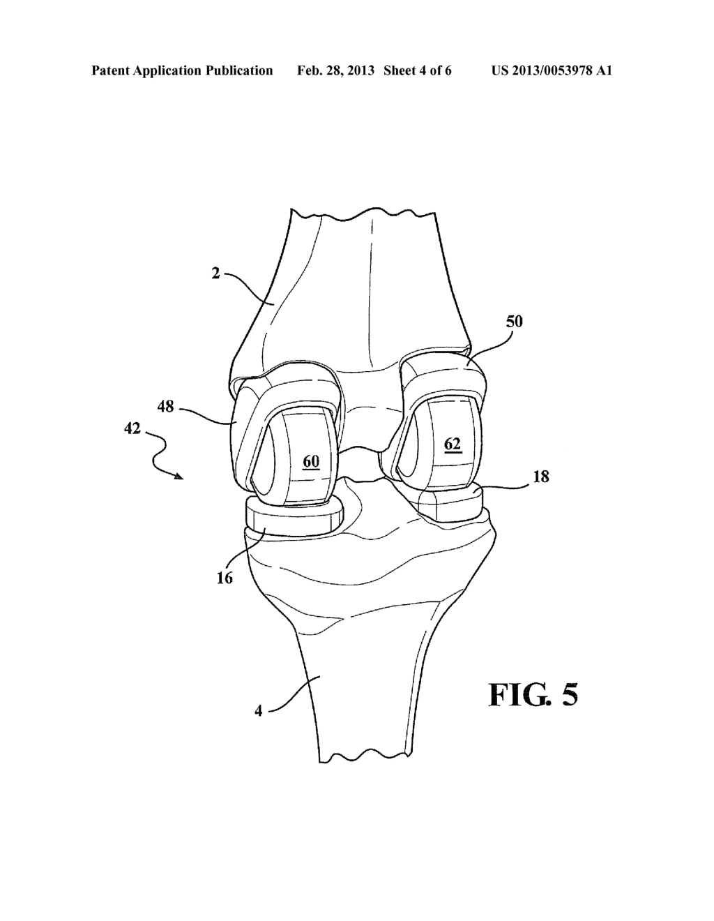 KNEE IMPLANT ASSEMBLY WITH ROTARY BEARING SUPPORTED AND TRAVELING SURFACES - diagram, schematic, and image 05