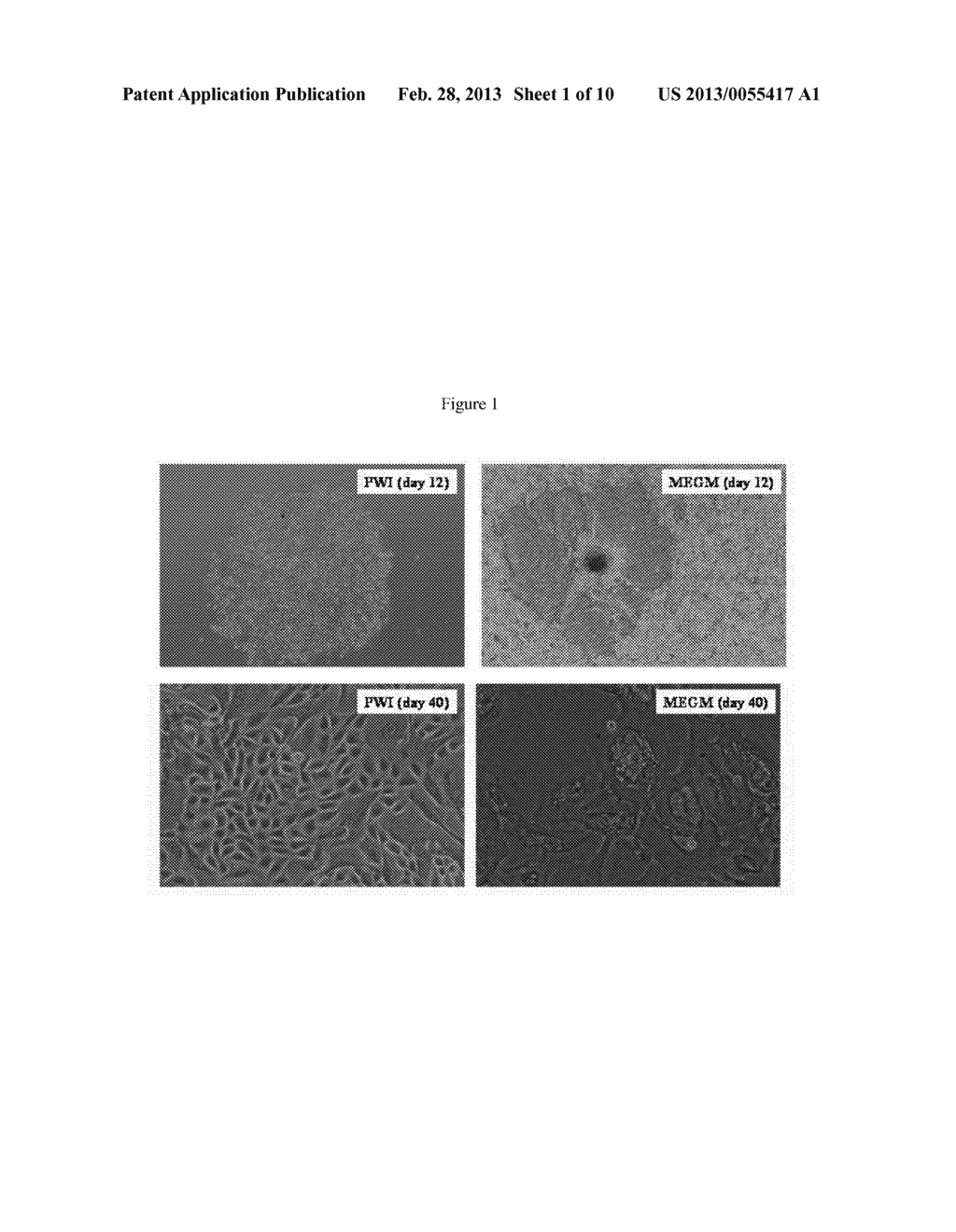 HORMONE RESPONSIVE TISSUE CULTURE SYSTEM AND USES THEREOF - diagram, schematic, and image 02