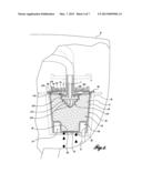 BEVERAGE BREWING DEVICE diagram and image